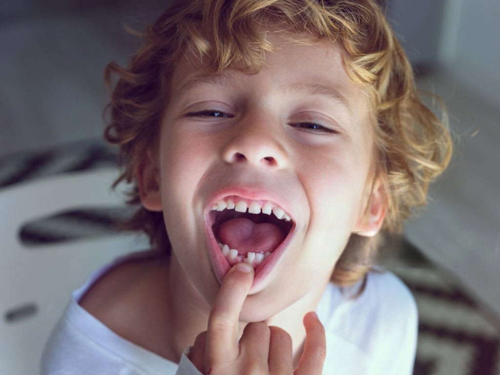 Le maintien d'espace Pédodontistes Le Vésinet 78 92 Maison de Dentistes Pédiatriques, Sommeil et Interception Orthodontie Dental Kids Friendly Paris